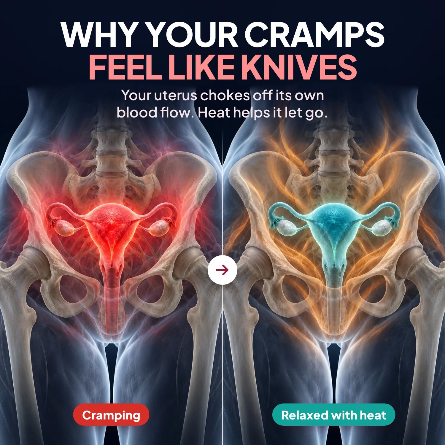 Why your cramps feel like knives: your uterus chokes off its own blood flow